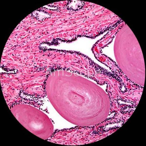 AmScope PS25-BSC12-72P100S22 25 Piece Microscope Prepared Slides, 72 Piece Pre-Cleaned Blank Plate Slides, 12 Piece Single Depression Concave Slides and 100 Piece Coverslips